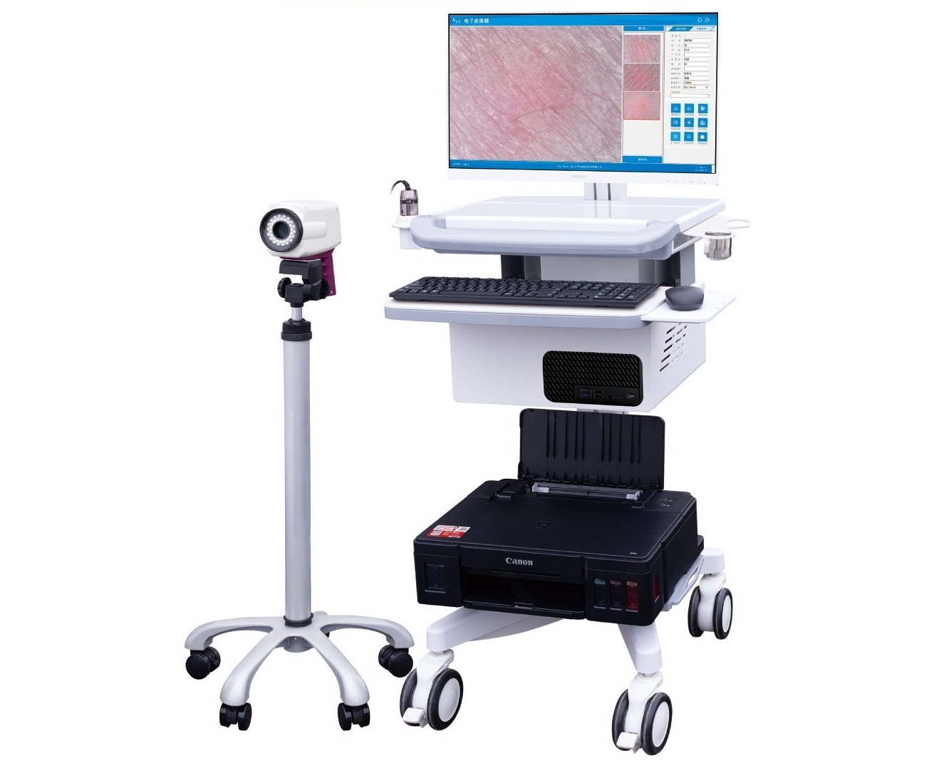 高清电子皮肤镜